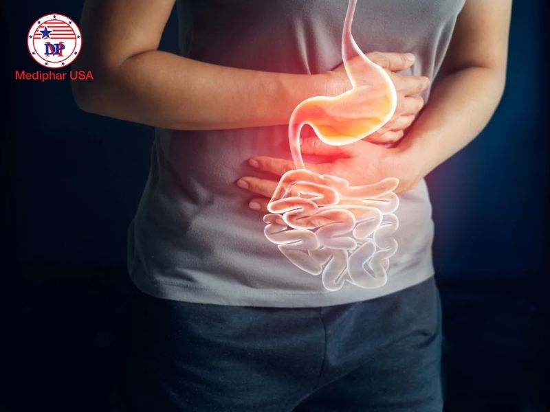 Rối loạn tiêu hóa: Nguyên nhân, triệu chứng, cách điều trị và phòng ngừa Rối loạn tiêu hóa là trình trạng bất thường xảy ra trong đường tiêu hóa