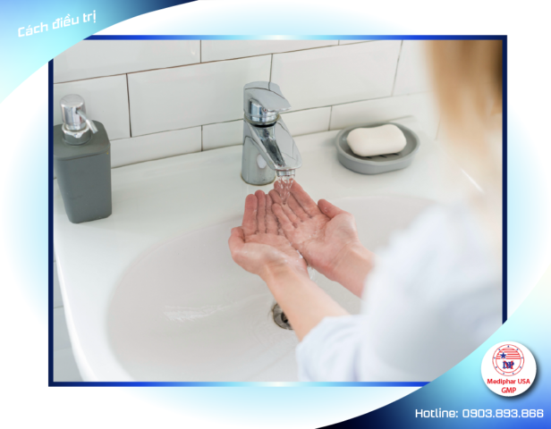 Rửa tay đúng cách giúp điều trị giun kim hiệu quả