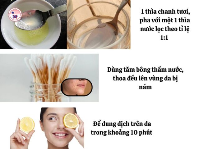 Sử dụng chanh để trị nám hiệu quả 