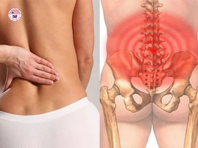 Bị đau lưng dưới gần mông ở nữ giới