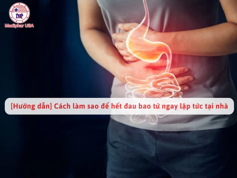 [Hướng dẫn] Cách làm sao để hết đau bao tử ngay lập tức tại nhà