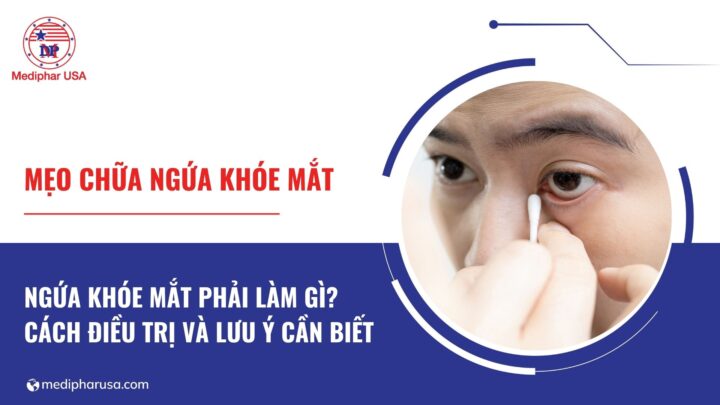 Mẹo chữa ngứa khóe mắt tại nhà