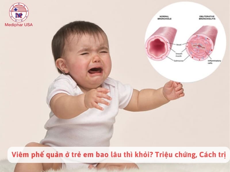 Viêm phế quản ở trẻ em bao lâu thì khỏi? Triệu chứng, Cách trị