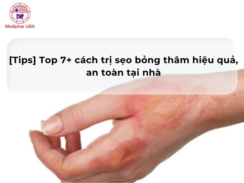 [Tips] Top 7+ cách trị sẹo bỏng thâm hiệu quả, an toàn tại nhà