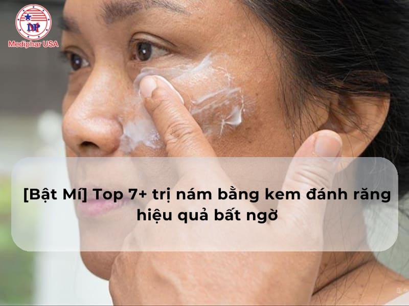 [Bật Mí] Top 7+ cách trị nám bằng kem đánh răng hiệu quả bất ngờ