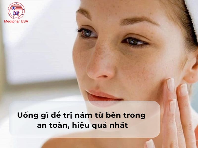 Uống gì để trị nám từ bên trong an toàn, hiệu quả nhất