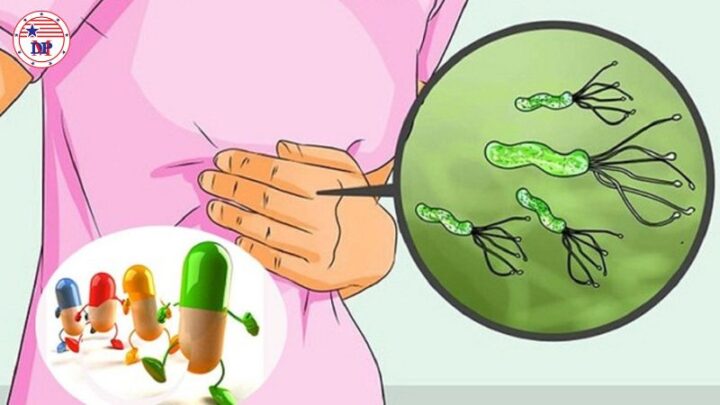 Thuốc kháng sinh diệt H. pylori