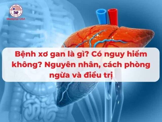 Bệnh xơ gan là gì? Có nguy hiểm không? Nguyên nhân, cách phòng ngừa và điều trị
