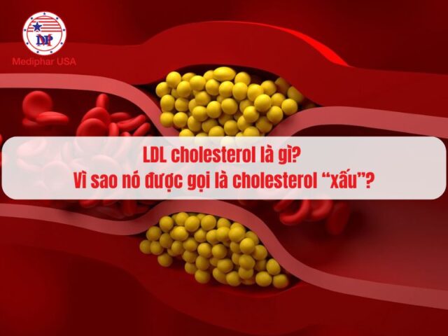 LDL cholesterol là gì? Vì sao nó được gọi là cholesterol “xấu”? LDL cholesterol là gì? Vì sao nó được gọi là cholesterol “xấu”?
