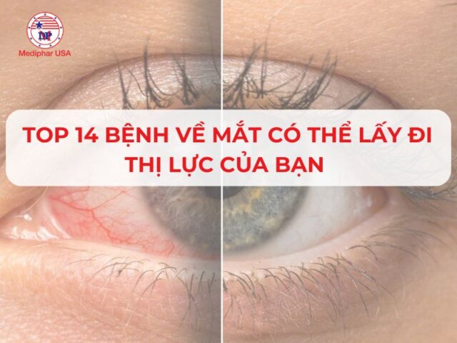 các bệnh về mắt