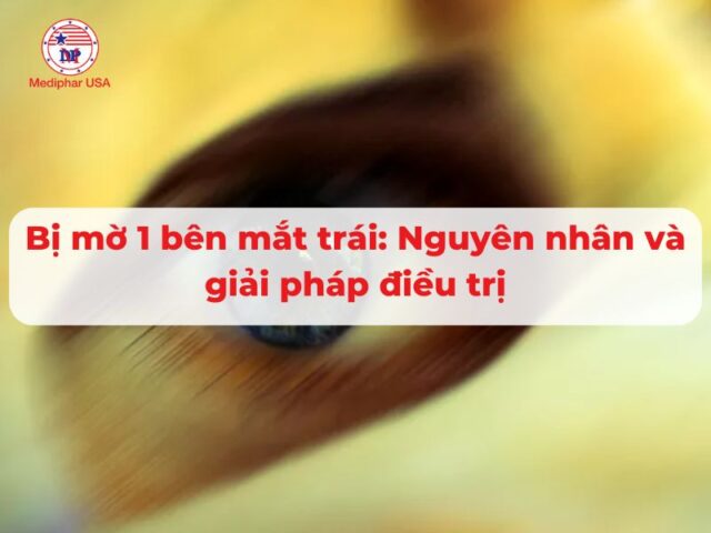 Bị mờ 1 bên mắt trái