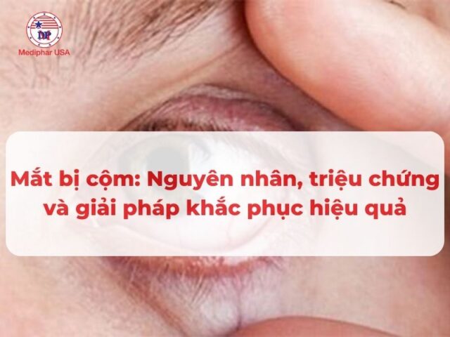 Mắt bị cộm: Nguyên nhân, triệu chứng và giải pháp khắc phục hiệu quả