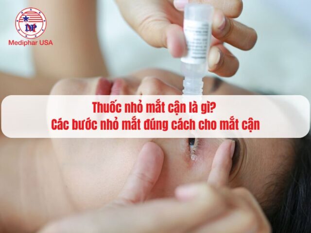 thuốc nhỏ mắt cận