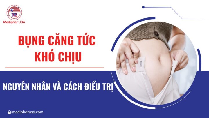 Bụng căng tức khó chịu: Nguyên nhân, cách xử lý và phòng ngừa bụng căng tức khó chịu