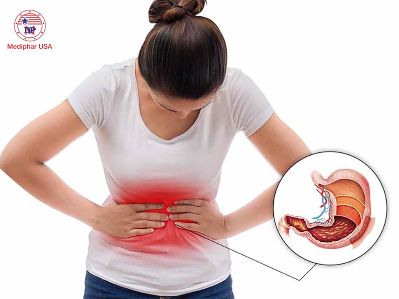 Bụng căng tức khó chịu: Nguyên nhân, cách xử lý và phòng ngừa bụng căng tức khó chịu