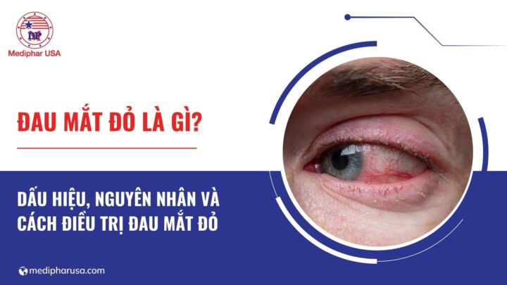 Đau mắt đỏ: Dấu hiệu, nguyên nhân và cách điều trị Đau mắt đỏ