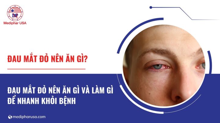 Đau mắt đỏ nên ăn gì