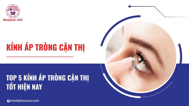 Kính áp tròng cận thị loại nào tốt