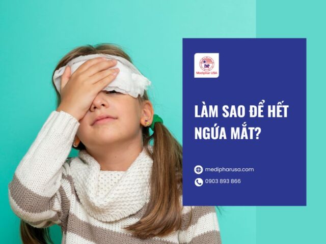 Ngứa mắt là bị gì? Nguyên nhân, dấu hiệu và cách trị Làm sao để hết ngứa mắt?