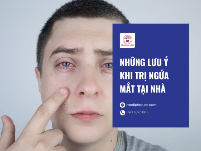 Ngứa mắt là bị gì? Nguyên nhân, dấu hiệu và cách trị Những lưu ý khi trị ngứa mắt tại nhà