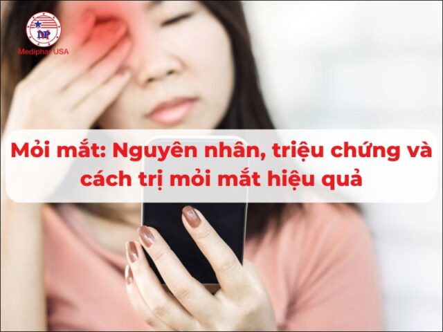 Mỏi mắt: Nguyên nhân, triệu chứng và hướng điều trị mỏi mắt