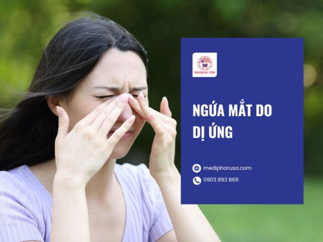 Ngứa mắt là bị gì? Nguyên nhân, dấu hiệu và cách trị Nguyên nhân gây ngứa mắt