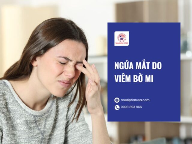 Ngứa mắt là bị gì? Nguyên nhân, dấu hiệu và cách trị Ngứa mắt do viêm bờ mi