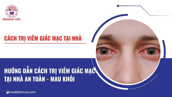 Cách trị viêm giác mạc tại nhà