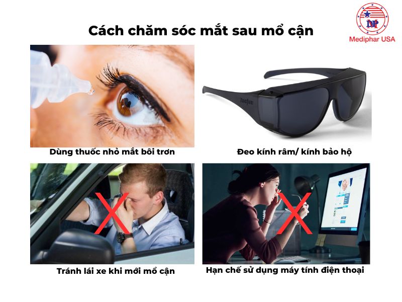 Cách chăm sóc mắt sau khi mổ cận thị