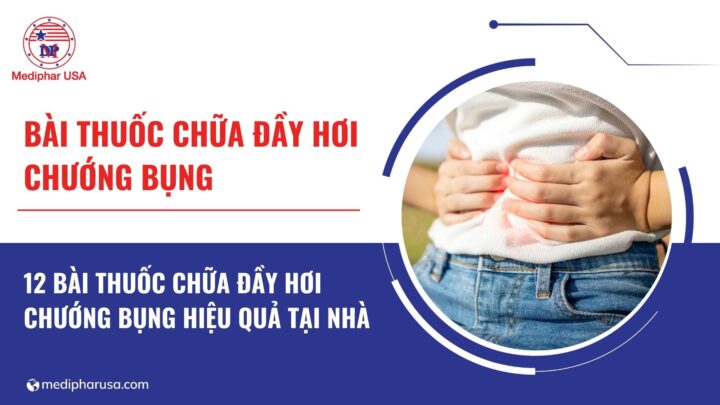 12 bài thuốc chữa đầy hơi chướng bụng giúp cải thiện triệu chứng tại nhà