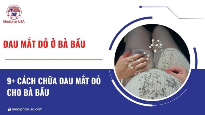 Cách chữa đau mắt đỏ cho bà bầu