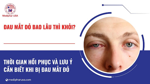 Bị đau mắt đỏ bao lâu thì khỏi hẳn