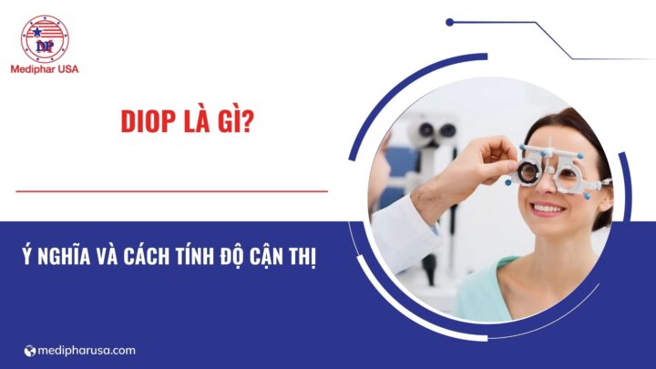 Đi ốp là gì