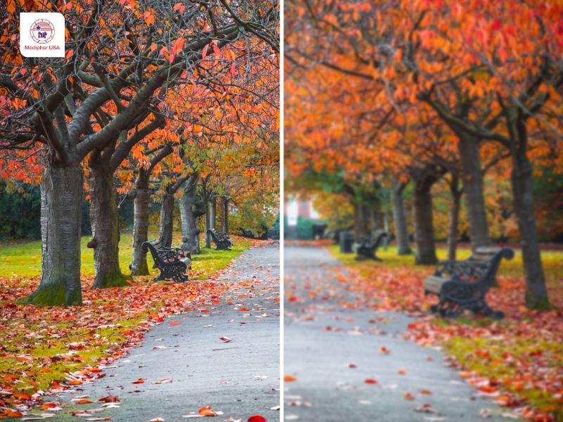 Hình ảnh góc nhìn của người loạn thị