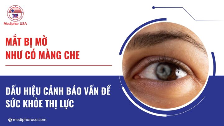 Mắt bị mờ như có màng che