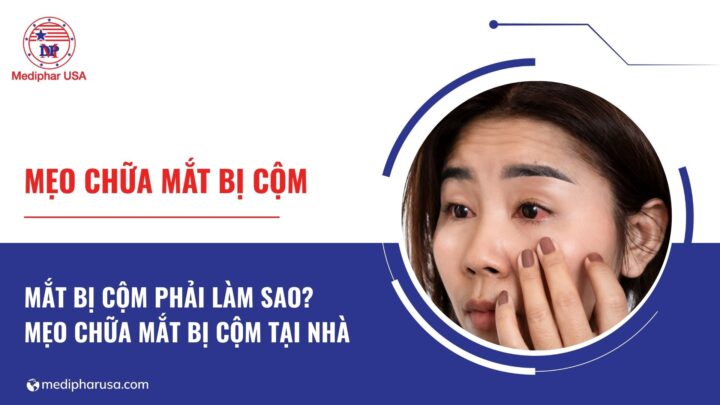 Mẹo chữa mắt bị cộm