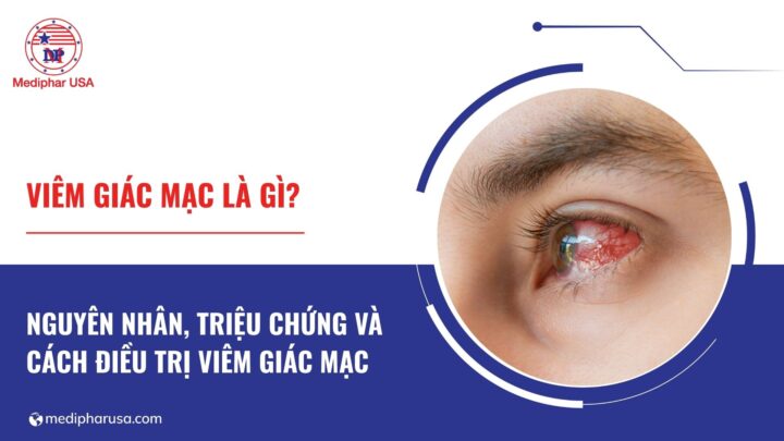 Viêm giác mạc