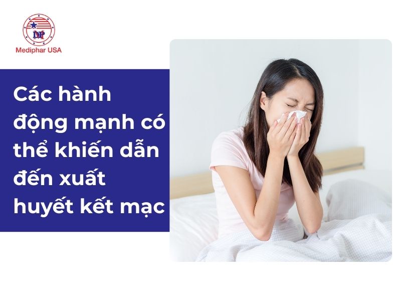 Xuất huyết dưới kết mạc là gì? Có nguy hiểm không? Nguyên nhân gây xuất huyết dưới kết mạc