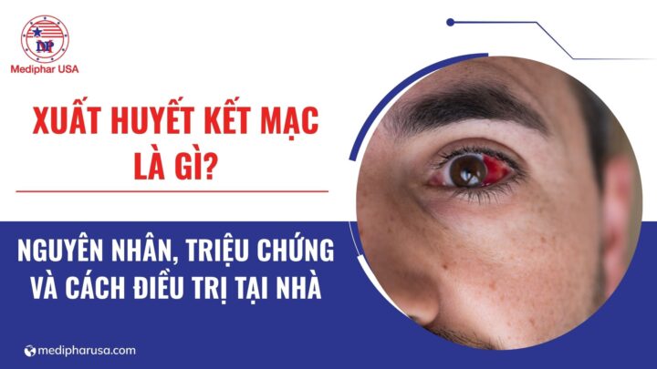 Xuất huyết dưới kết mạc