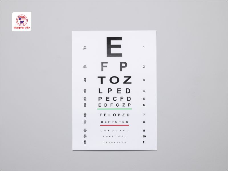 Bảng đo thị lực: Hướng dẫn cách đọc, sử dụng và ý nghĩa kết quả Trước khi đo thị lực, cần chuẩn bị không gian thoáng đãng không có vật cản, đảm bảo ánh sáng đầy đủ và đều.