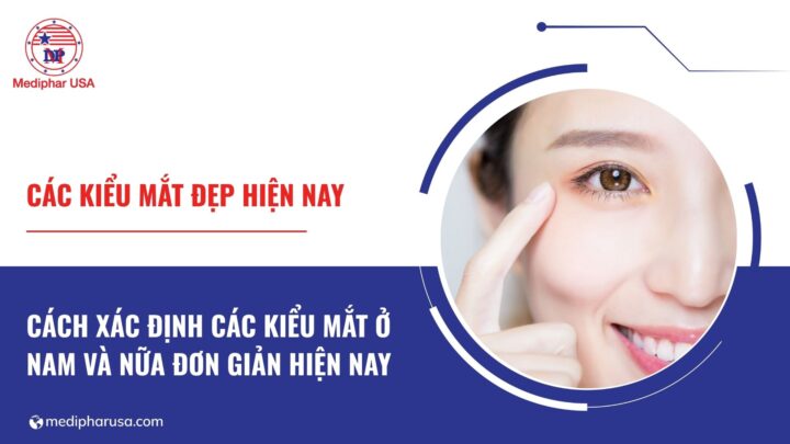 các kiểu mắt