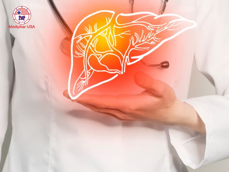 Đau bụng giữa là gì? Nguyên nhân và các biện pháp hỗ trợ hiệu quả Viêm gan gây cảm giác đau tức hoặc âm ỉ ở vùng bụng giữa bên phải