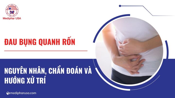 đau bụng quanh rốn