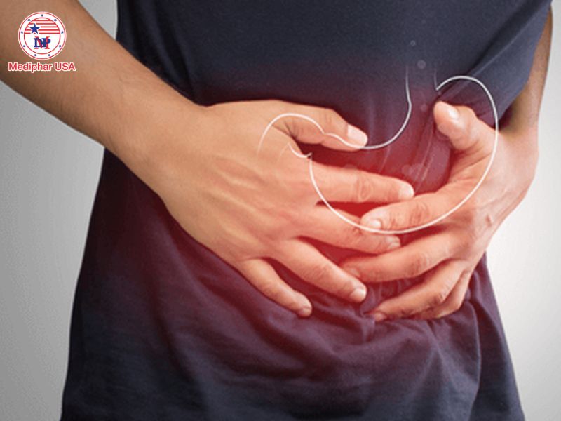 Đau bụng quanh rốn: Nguyên nhân, chẩn đoán và hướng xử trí đau bụng quanh rốn