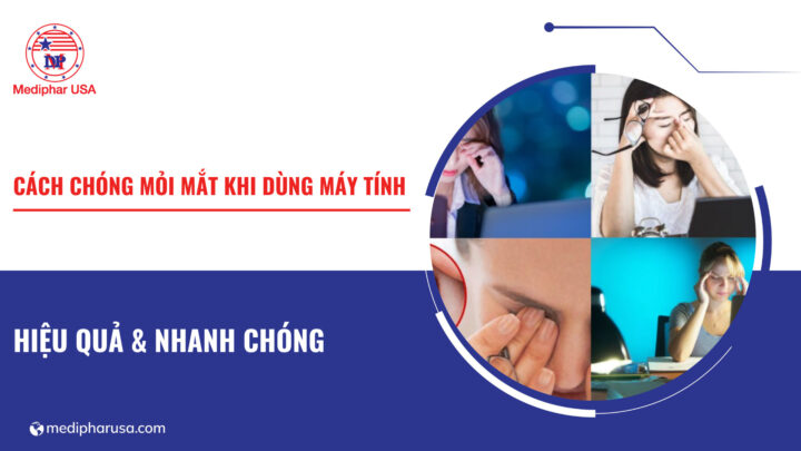 cách chóng mỏi mắt khi dùng máy tính