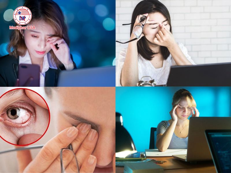 5 cách chống mỏi mắt khi dùng máy tính hiệu quả Dấu hiệu cho thấy mắt đang bị kiệt sức khi dùng máy tính