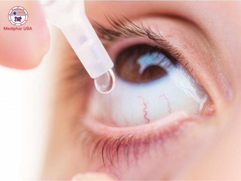 Giác mạc: Cấu trúc, chức năng và các bệnh lý thường gặp Sử dụng một số thuốc nhỏ mắt giúp làm dịu giác mạc tạo điều kiện cho quá trình phục hồi