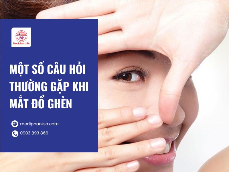 Mắt đổ ghèn bị là gì? Tìm hiểu nguyên nhân và cách khắc phục Một số câu hỏi thường gặp khi bị mắt đổ ghèn