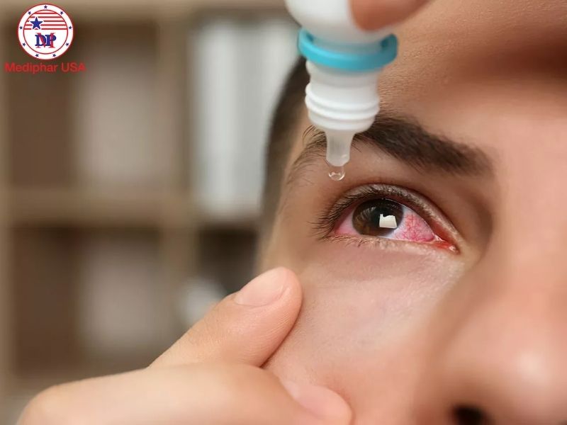 Mách bạn 7 nhóm thực phẩm tốt cho mắt khô Bạn có thể sử dụng nước mắt nhân tạo để tăng độ ẩm cho mắt