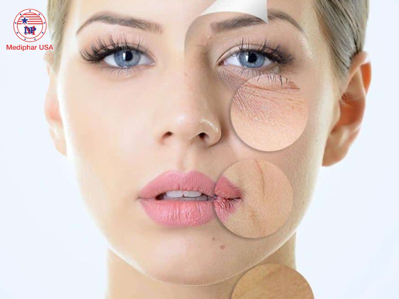 Giải đáp: Uống nước dừa mỗi ngày có đẹp da không? Uống nước dừa mỗi ngày giúp làm chậm sự xuất hiện của nếp nhăn, giữ cho da luôn tươi trẻ và rạng rỡ.